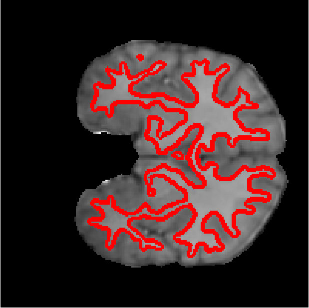 Figure 26